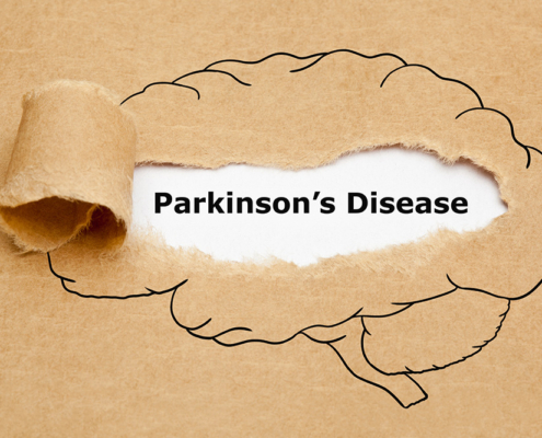 slow parkinson's progression