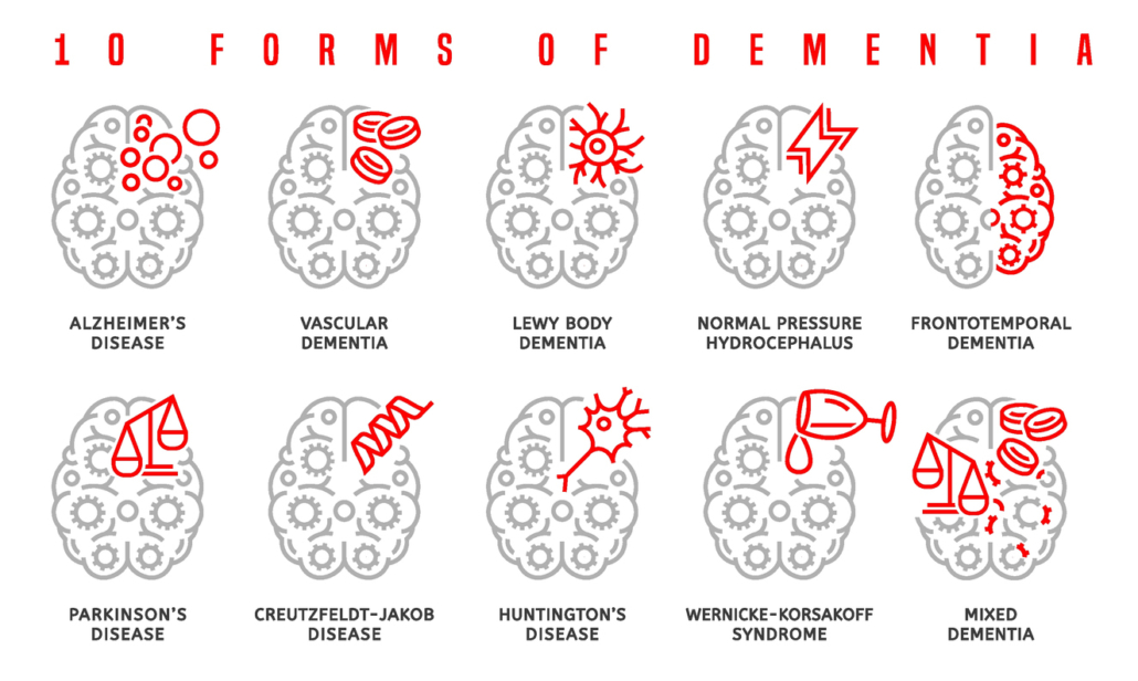 Vector dementia infographic