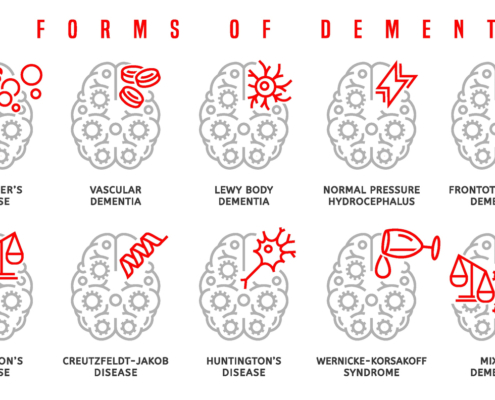 Vector dementia infographic in outline style.