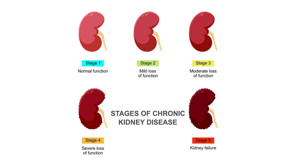 kidney disease graphic