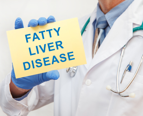 Fatty Liver Disease