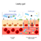 Leaky Gut