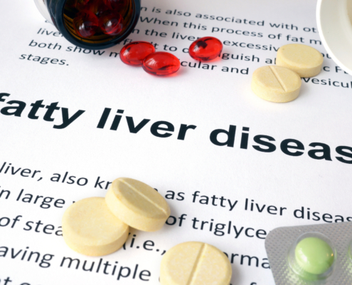 Fatty Liver Disease