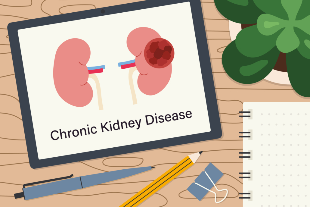 Chronic Kidney Disease