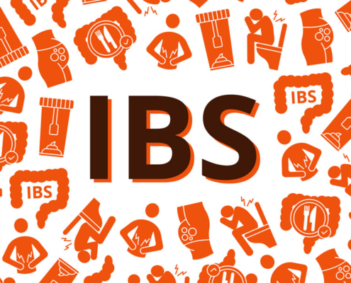 Managing IBS
